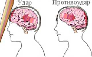 Осложнения после травм головного мозга (сотрясение, ушиб головного мозга)