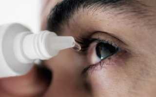 Лечение ожога под глазом от крема или мази