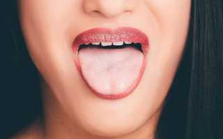 Фиброма десны в полости рта: лечение, может ли рассосаться сама